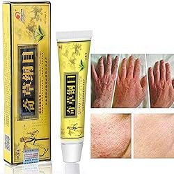 2pcs Chinese Herbal Eczema, Psoriasis Creams Dermatitis and Eczema Pruritus Psoriasis CEZUBEM Ointment