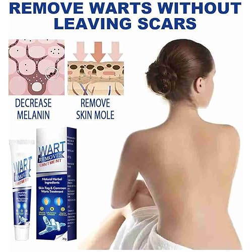 Wart Remover Cream, Skin Tag Remover, Lnstant Blemish Removal Gel, Skin Wart Removal Cream Body Warts Treatment, Quickly and Easily Effective Remove Common Skin Tag Remover 2PCS