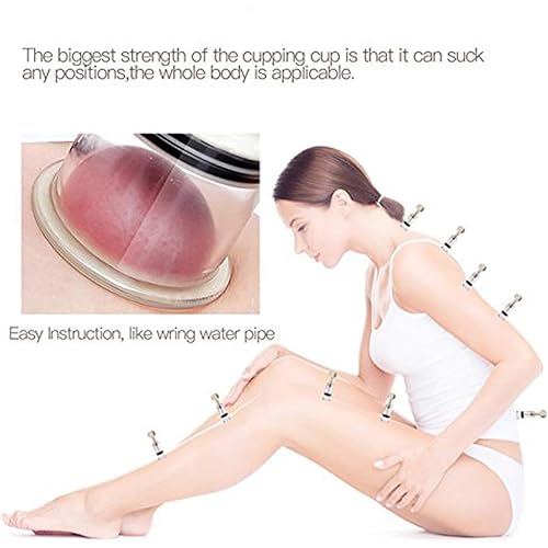 Vacuum Cupping Multi-Functional Rotary Magnetic Therapy Cupping Device Relax Biomagnetic Chinese Cupping Therapy Set 2PCSL