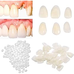 Womcare Temporary Tooth Repair kits for Filling The Missing Broken Tooth and Gaps-Moldable Fake Teeth and Thermal Beads Replacement Kits