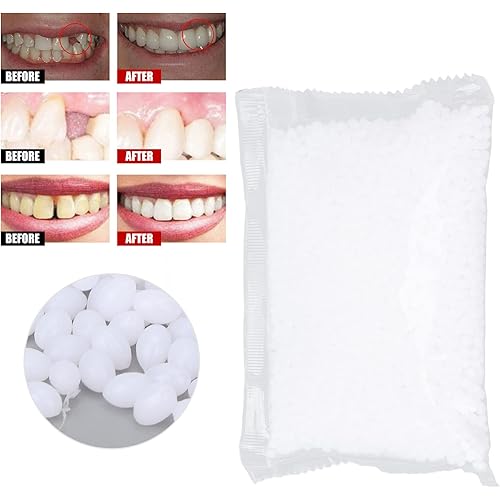 Moldable Thermal Fitting Bead,Temporary Tooth Filling Bead, Makeup Filling Fix the Missing Broken Tooth or Adhesive the Denture Fake Teeth,Repair Accessory for Halloween Party 100g