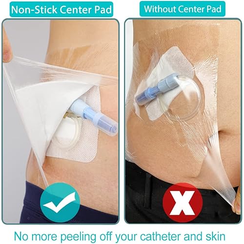 Waterproof PD Dialysis Catheter Shower Cover Wound Shields Picc Line Bandage Chest Peritoneal Chemo Port Feeding Tube G-Tube Water Barrier Protector 9 x 9 Inch with Non-Stick Center Pad Pack of 25