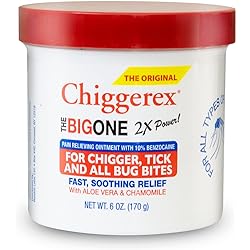 Chiggerex 2X Power First Aid Medicated Ointment for Chiggers, Mosquito Bites, Ticks and Bug Bite Relief with Aloe Vera & Chamomile, 6 oz