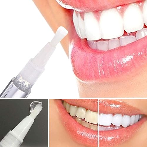 V-WHITE Foam Whitening Toothpaste with Deep Cleansing Teeth Whitening Gel & Pen– Gluten, Fluoride & Alcohol Free for Adults & Kids Toothpaste 60 ml – Brighten Your Teeth and Kills Bad Breath