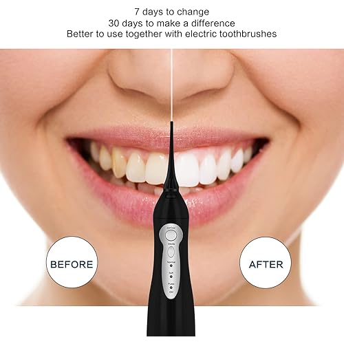 Tovendor Electric Toothbrush with Water Flosser for Family Hygiene, Home and Travel Use Fast USB Charging, IPX7 Waterproof