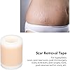 Scar Removal Tape, Scar Removal Tape Roll Waterproof Promotes Restores Elasticity for Postpartum Recovery