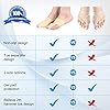 DOACT Bunion Corrector, Bunion Corrector Big Toe Straighteners with Separator, Suitable for Hallux Valgus, Separation of Toes, Unique Heel Strap Design Prevents Falling Off L Size