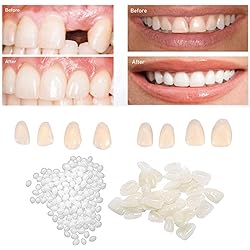 CZsy Temporary Tooth Repair Kit,50g Filling Tooth Beads and 60pcs for Fix The Missing Tooth Veneers,for Fix Filling The Missing Broken Tooth and Gaps,Artfifical Teeth