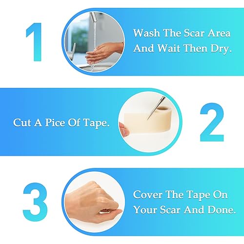 OBTANIM Silicone Scar Removal Sheets Reusable Scar Reduction Pads for Scars Caused by C-Section Keloid Burn Surgery Acne, 1.57 Inch x 3.3 Ft