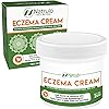 Natrulo Natural Eczema & Psoriasis Cream 2oz – Itch Ointment Lotion for Adults, Kids, Baby – Safe, Gentle on Sensitive Skin, Moisturizing, Herbal Face & Body Flare Up Treatment