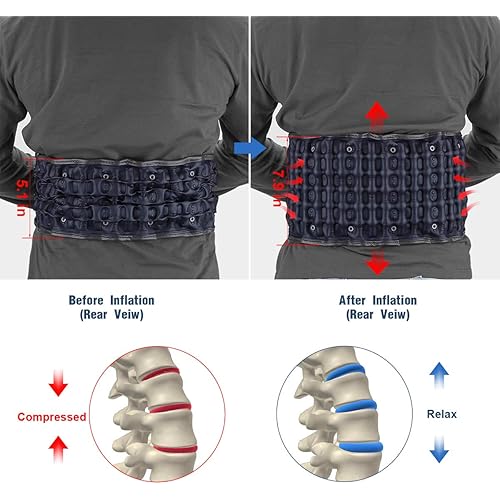 HONGJING Decompression Back Belt for Lower Back Pain Relief- Spine Reset Device Lumbar Support for Lifting, One Size Fits 29-49 Waist