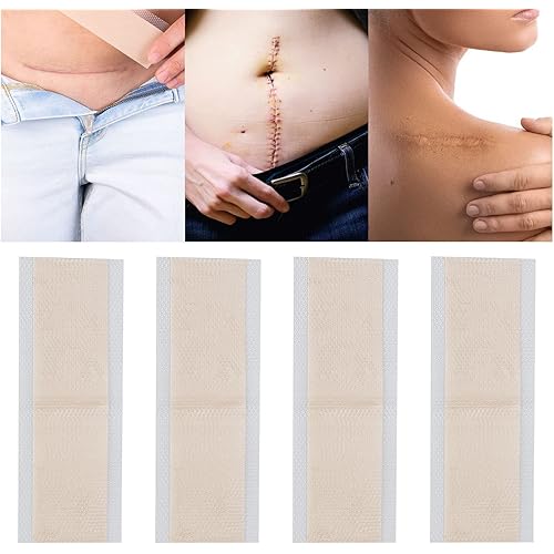 4 Pcs Scar Covering Sticker Ultra Thin Breathable Comfortable Reducing Softening Scars Skin Scar Concealing Tape Scar Cover Tapes