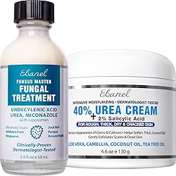 Ebanel Bundle of 40% Urea Cream 4.6 Oz, and Fungus Treatment 2 Oz