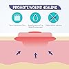 Conkote Hydrocolloid Wound Dressing 4”x 4”, Sterile Adhesive Patches, Box of 10 Dressings