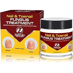 Natrulo Nail & Toenail Treatment - Herbal Nail Cream with Tolnaftate & Essential Oils - Repairs & Restores Clear Healthy Nails - Effective Proven Formula Made in the USA