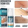 Old New Scar Repair Gel, Fading Mild Greasy Free Massage Absorbing 50ml Scar Cream 2pcs for Age Pigment for Wrinkles