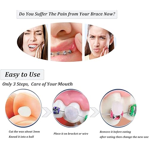 Wenplus 10 Pack Dental Wax Oral Care Orthodontics Wax for Braces Wearer - White Color Original Scent