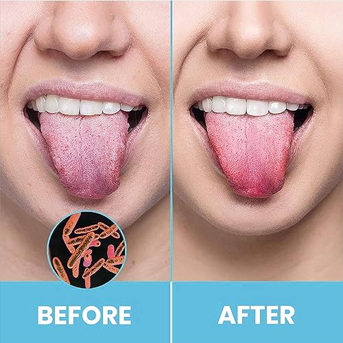 Tongue Scraper for Adults by HOKIN 2Pcs Oral Care Pack Stainless Steel Tongue Cleaners Reduce Bad Breath 100% Metal Tough Scrapers Men and Women Hygiene Product